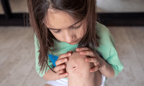 What Is an Infected Insect Bite?