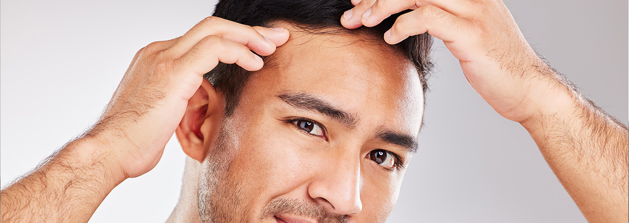 Male Pattern Baldness at Higher Crumpsall Pharmacy