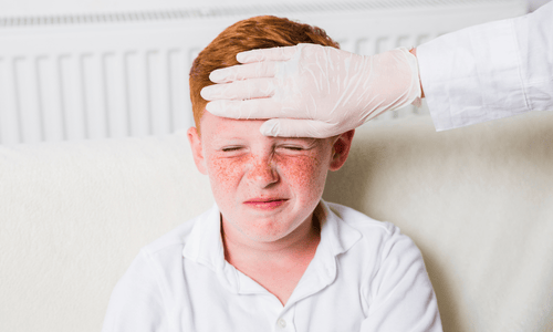 What Is Impetigo?